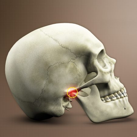 Temporomandibular Eklem Problemleri Temporomandibular Eklem Problemleri